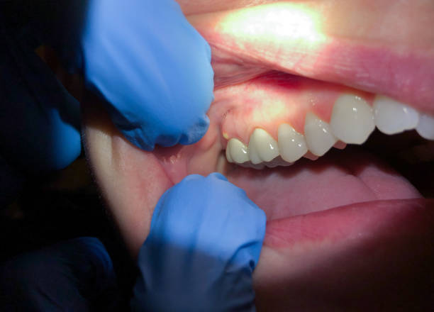 Best Emergency Dentist for Special Needs Patients in Duncannon, PA